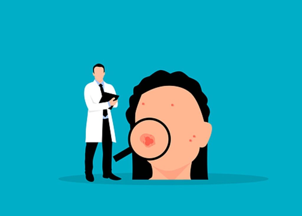 What Are The Best Treatments For Acne